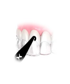 Posicionador y Extractor de Elasticos