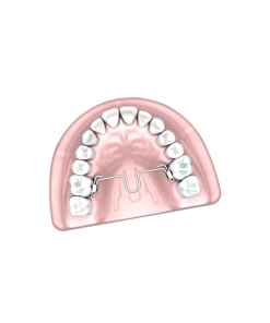 Barra Palatina Distal