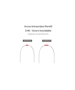Arco Acero Diagrama