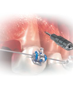 Llave-Hexagonal-para-Microtornillos-Digital