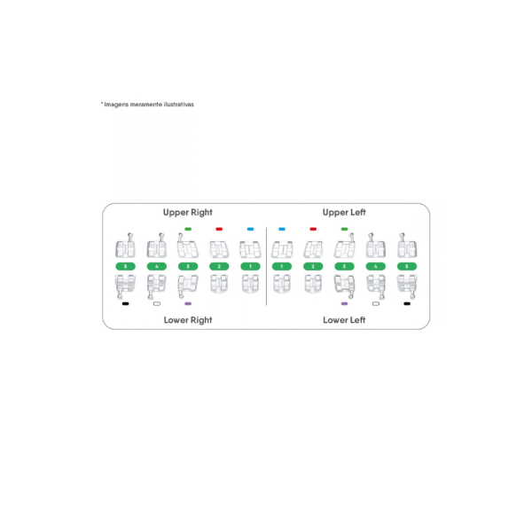 Kit de Brackets KiriOne MBT .022 – 10 Casos | iD-Logical - Imagen 5